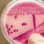 Candida auris, seria minaccia probabilmente creata dai fungicidi usati per conservare la frutta