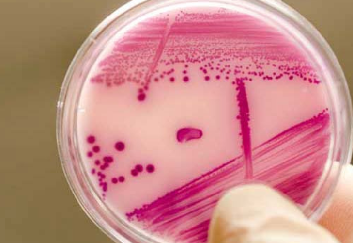 Candida auris, seria minaccia probabilmente creata dai fungicidi usati per conservare la frutta