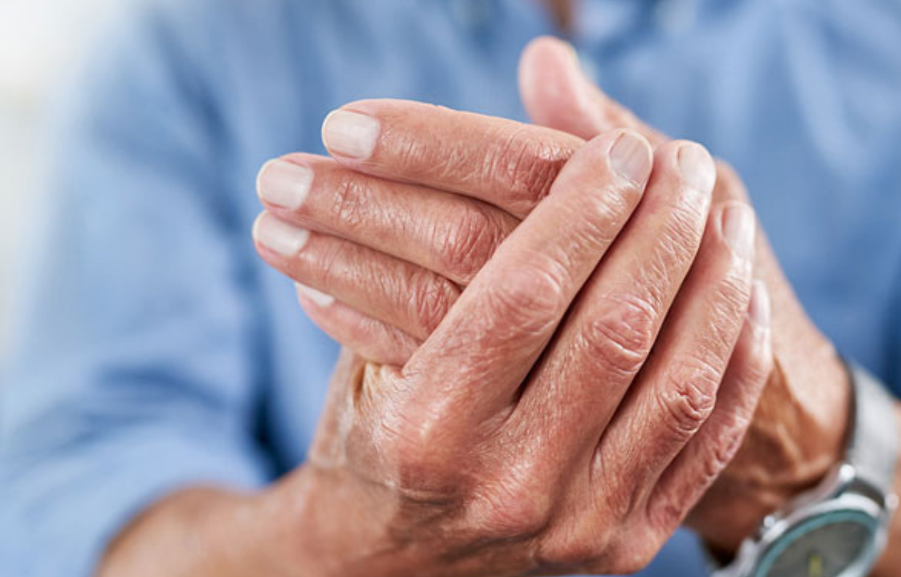 Curcuma, Boswellia e Vitamina D per l'osteoartrosi della mano