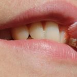 Denti curati, meno complicanze in sala operatoria