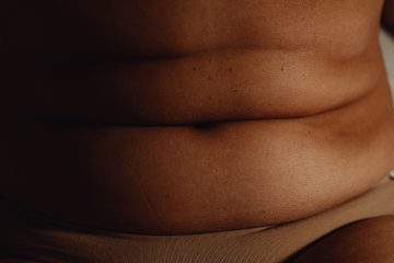 Celiachia: quando la dieta senza glutine non basta
